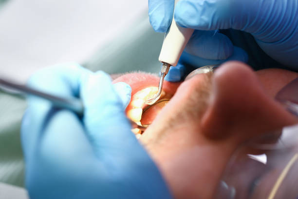 Best Tooth Pain Emergency Relief  in San Bruno, CA
