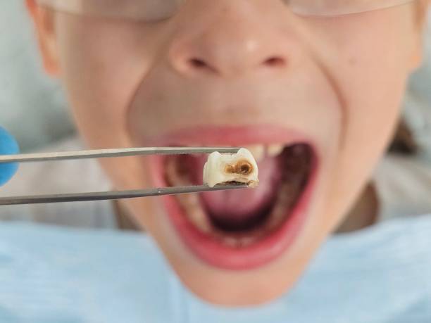 Best Emergency Dentist Near Me  in San Bruno, CA